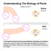 Male penis hook stretching traction device bracket extension correction physical training system