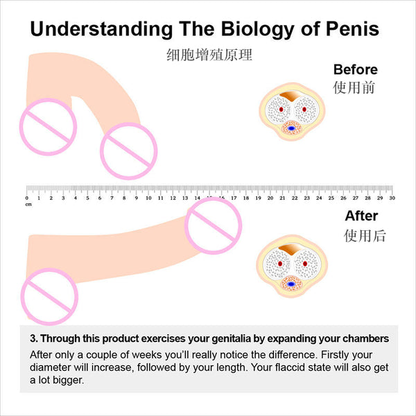 Male penis hook stretching traction device bracket extension correction physical training system