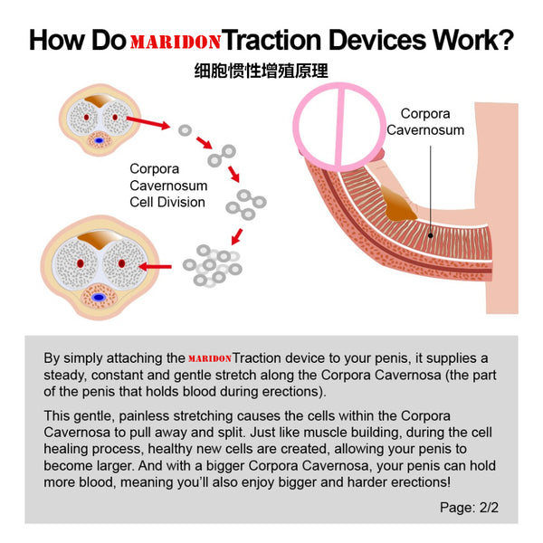 Male penis hook stretching traction device bracket extension correction physical training system